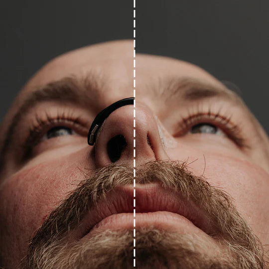 Ger stöd åt nässtrukturen